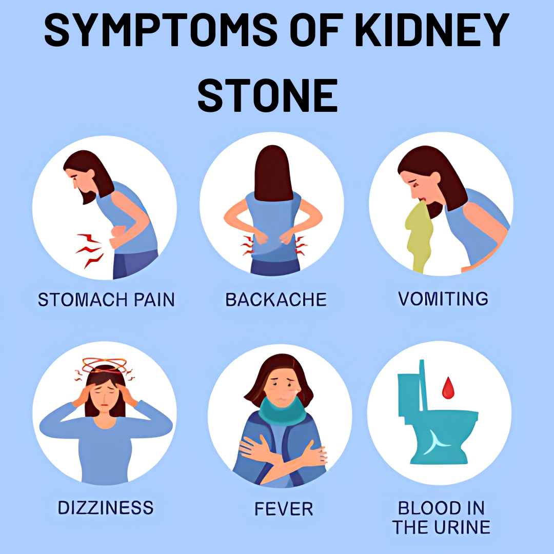 2X Faster Relief from Kidney Stones -Stonsoft Combo